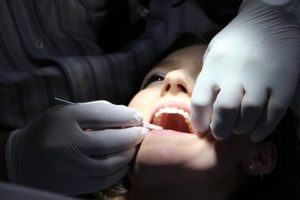 歯の治療